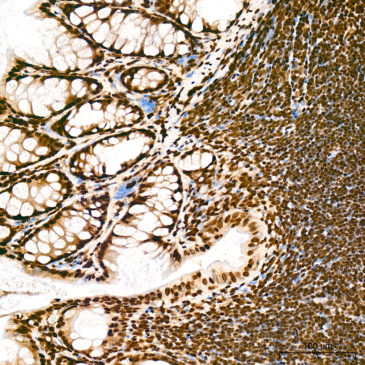 DiMethyl-Histone H3-K79 Rabbit mAb