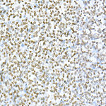 Western blot - Acetyl-Histone H3-K56 Rabbit mAb (A22145)