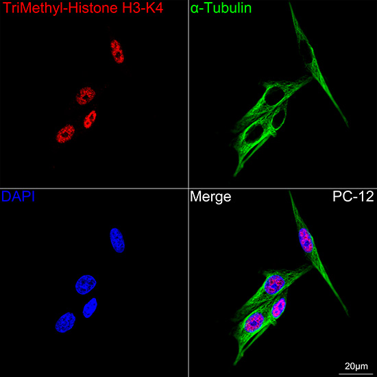 TriMethyl-Histone H3-K4 Rabbit mAb