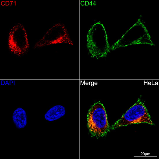 CD71/Transferrin Receptor Rabbit mAb