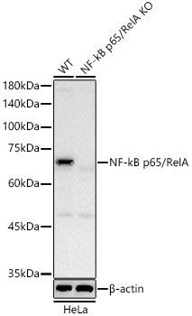 [KO Validated] NF-kB p65/RelA Rabbit mAb