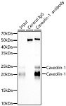 Western blot - Caveolin-1  Rabbit mAb (A22417)