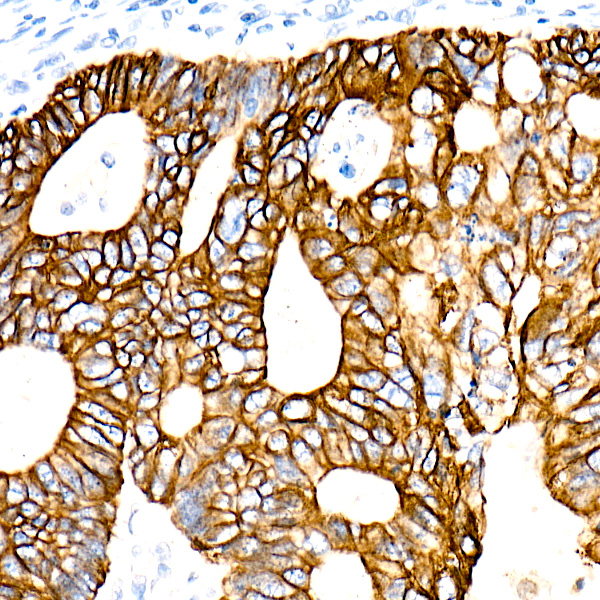 Cytokeratin 19 (KRT19) Rabbit mAb