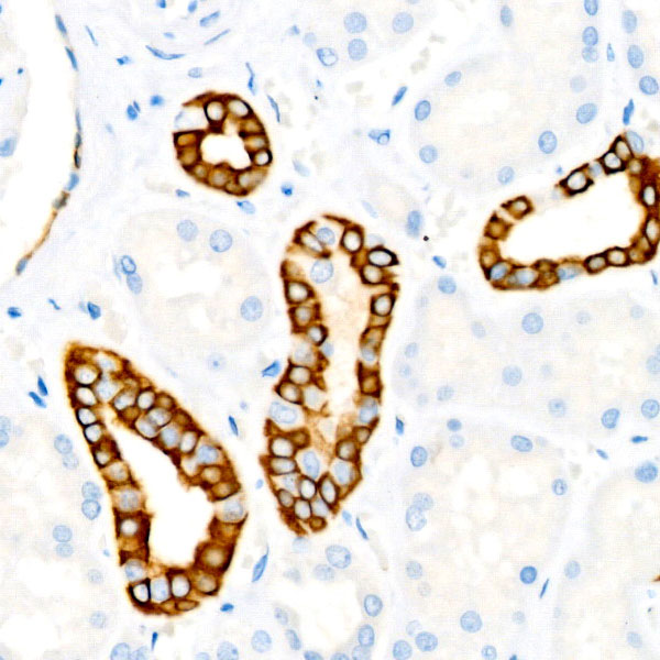 Cytokeratin 19 (KRT19) Rabbit mAb