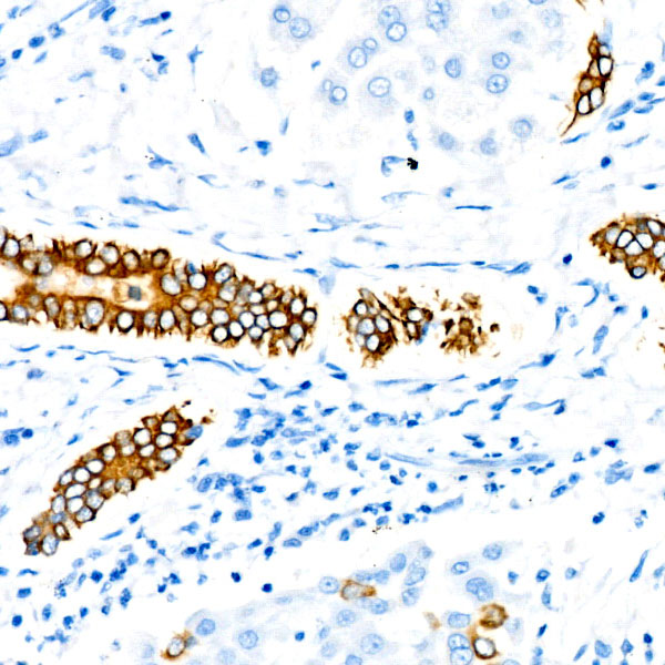 Cytokeratin 19 (KRT19) Rabbit mAb