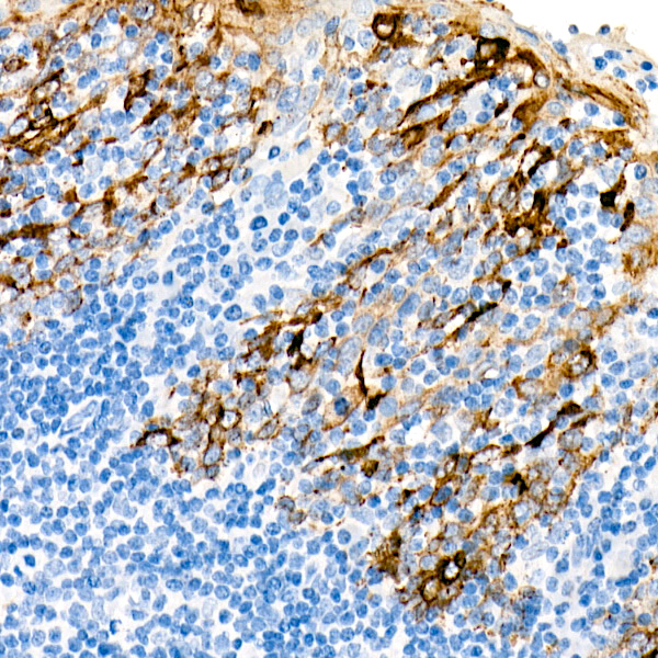 Cytokeratin 19 (KRT19) Rabbit mAb