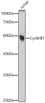 Cyclin B1 Rabbit mAb