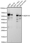 Western blot - ALDH1A1 Rabbit PolymAb® (A22531)