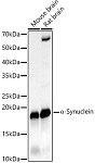 Western blot - α-Synuclein Rabbit PolymAb® (A22598)
