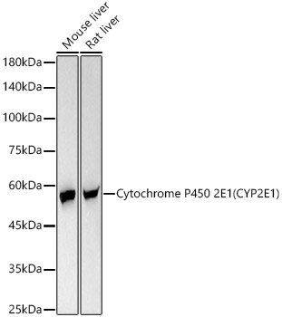 Cytochrome P450 2E1 (CYP2E1) Rabbit mAb