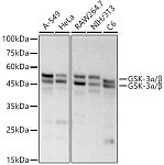 Western blot - GSK-3α/β Rabbit mAb (A22665)