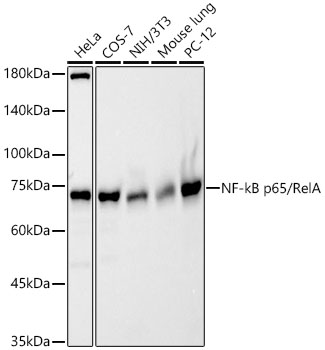 [KO Validated] NF-kB p65/RelA Rabbit pAb