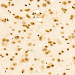Western blot - MonoMethyl-Histone H3-K36 Rabbit mAb (A22863)