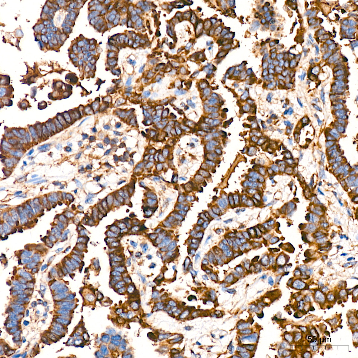 Caspase-12 Rabbit mAb