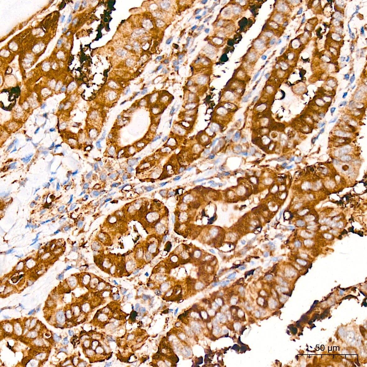 Caspase-12 Rabbit mAb