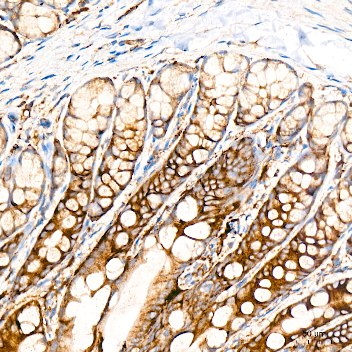 Caspase-12 Rabbit mAb