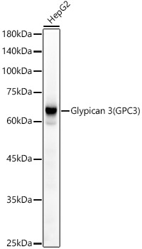 Glypican 3 (GPC3) Rabbit mAb