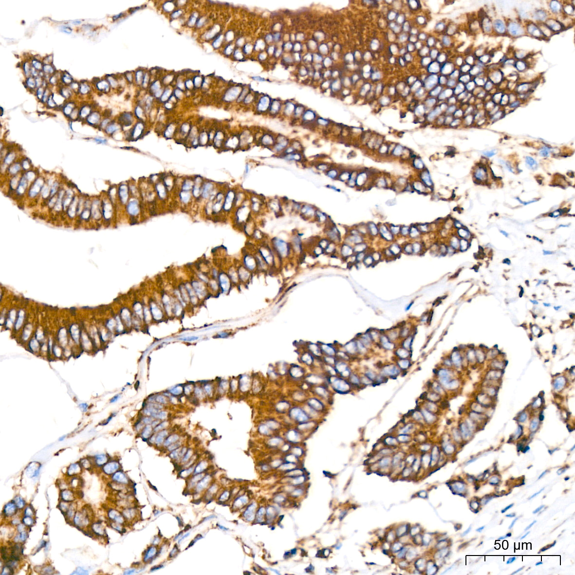 BiP/GRP78 Rabbit mAb