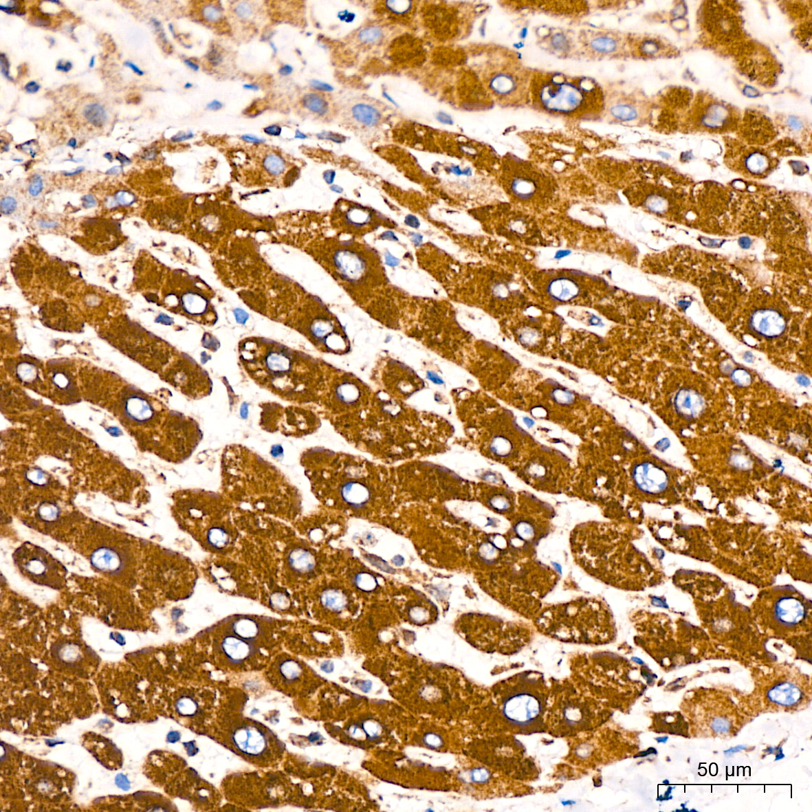 BiP/GRP78 Rabbit mAb