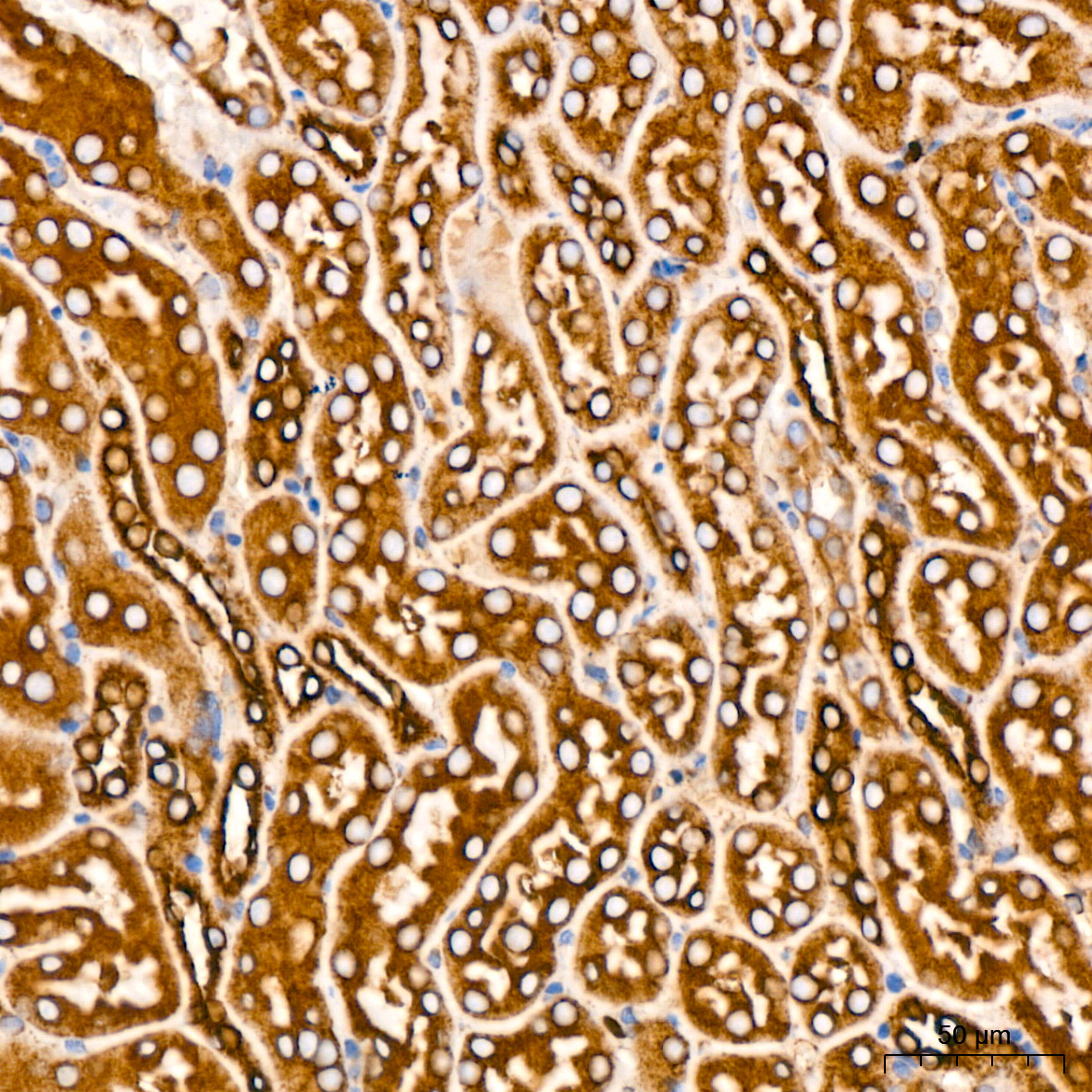 BiP/GRP78 Rabbit mAb