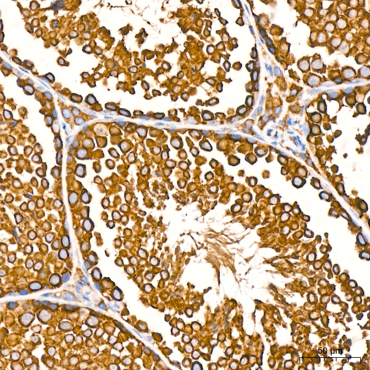 BiP/GRP78 Rabbit mAb