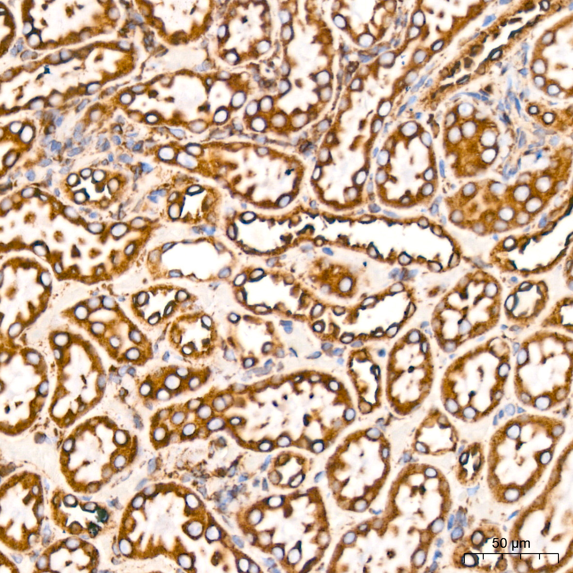 BiP/GRP78 Rabbit mAb