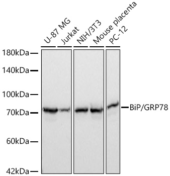 BiP/GRP78 Rabbit mAb