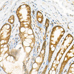 Western blot - NADPH oxidase 4 (NOX4) Rabbit mAb (A23465)