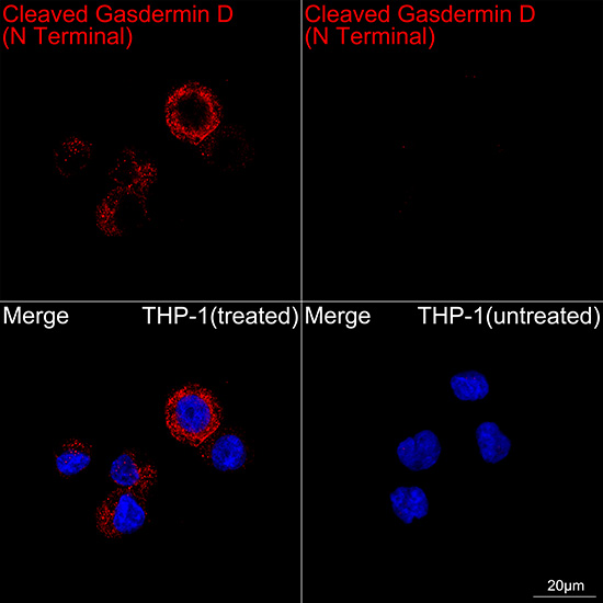 [KO Validated] Cleaved Gasdermin D (N Terminal) Rabbit mAb