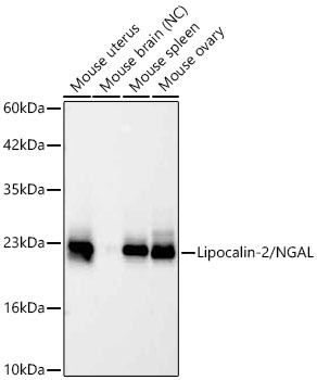 Lipocalin-2/NGAL Rabbit mAb