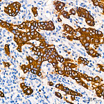 Western blot - Cytokeratin 19 (KRT19) Rabbit mAb (A24162)