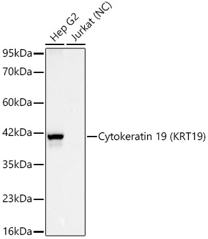 Cytokeratin 19 (KRT19) Rabbit mAb