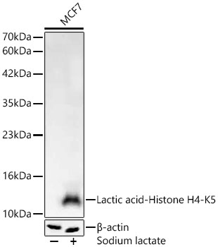 Lactic acid-Histone H4-K5 Rabbit mAb