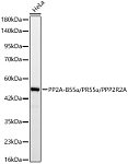 Western blot - PP2A-B55α/PR55α/PPP2R2A Rabbit mAb (A24261)