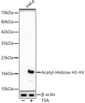 Acetyl-Histone H3-K4 Rabbit mAb