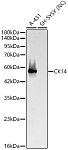 Western blot - CK14 Rabbit pAb (A24481)