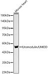Western blot - Uromodulin/UMOD Rabbit mAb (A24641)