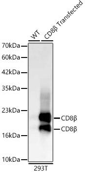 CD8β Rabbit mAb