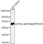 Western blot - PP2A-Aβ/PR65β/PPP2R1B Rabbit pAb (A24836)