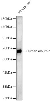 Human albumin Rabbit pAb