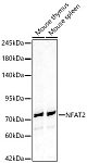 Western blot - NFAT2 Rabbit pAb (A24872)