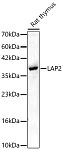 Western blot - LAP2 Rabbit pAb (A24875)