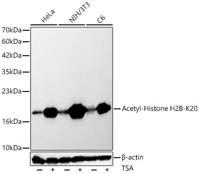 Acetyl-Histone H2B-K20 Rabbit pAb