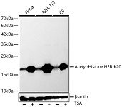 Western blot - Acetyl-Histone H2B-K20 Rabbit pAb (A24886)