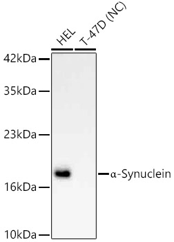 α-Synuclein Rabbit mAb