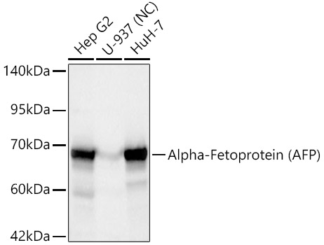 Alpha-Fetoprotein (AFP) Rabbit mAb