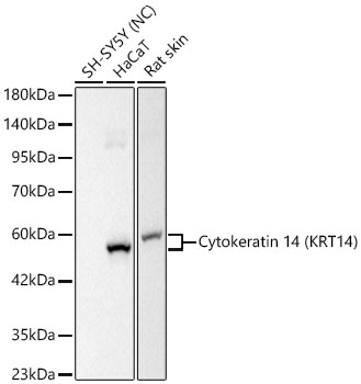 Cytokeratin 14 (KRT14) Rabbit mAb