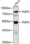 Western blot - TMPO Rabbit pAb (A2534)
