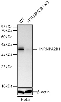 [KD Validated] HNRNPA2B1 Rabbit pAb