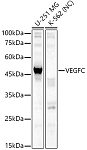 Western blot - VEGFC Rabbit pAb (A2556)